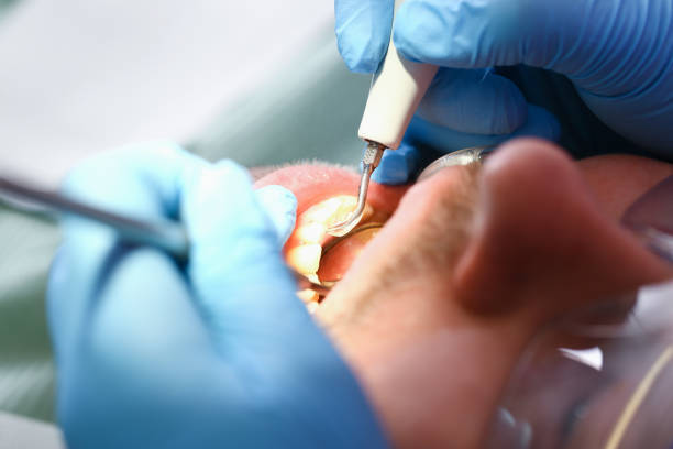 Best Emergency Gum Pain Relief  in Maria Stein, OH