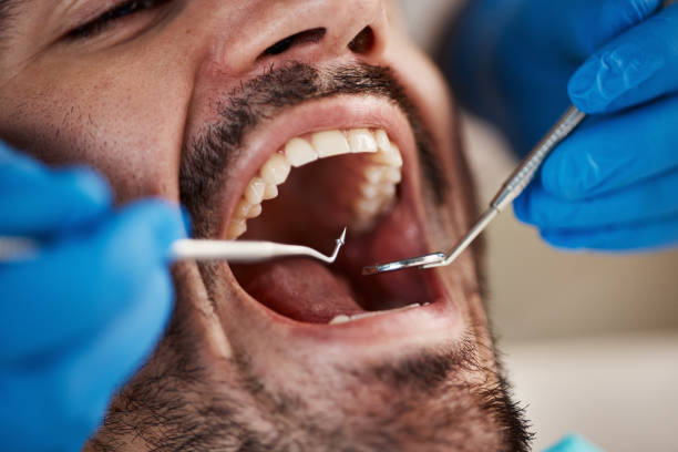 Best Emergency Tooth Extraction  in Maria Stein, OH