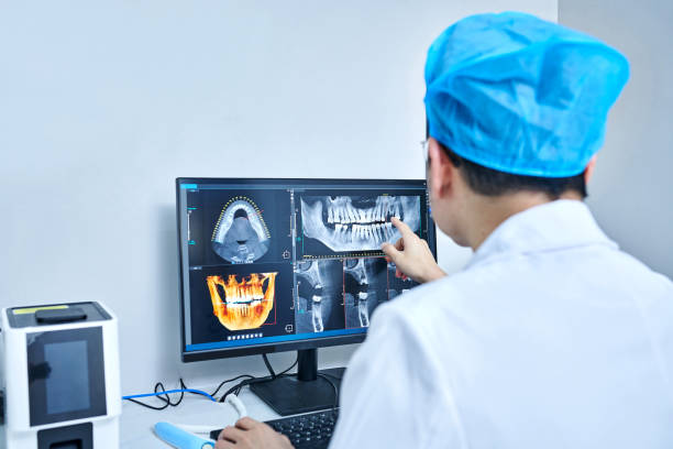 Best Chipped Tooth Repair Near Me  in Maria Stein, OH