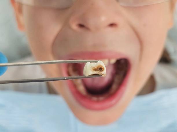Best Tooth Pain Emergency Relief  in Maria Stein, OH